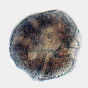 Peridinium - Class 60