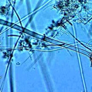 Stalked Ciliates